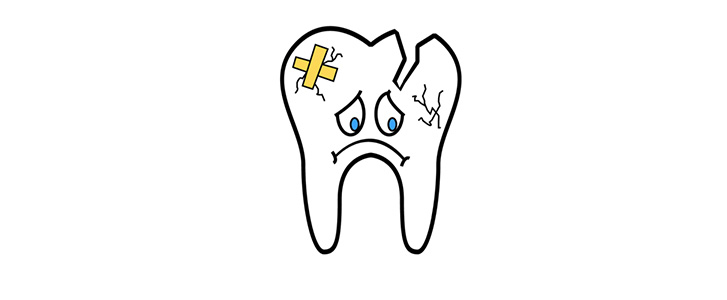 frattura dentale dentista bologna