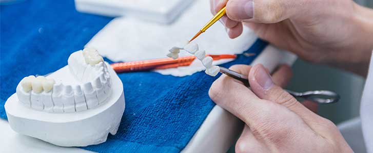 protesi dentali nuovi materiali